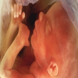 España permite abortar hasta el mismo momento del parto
